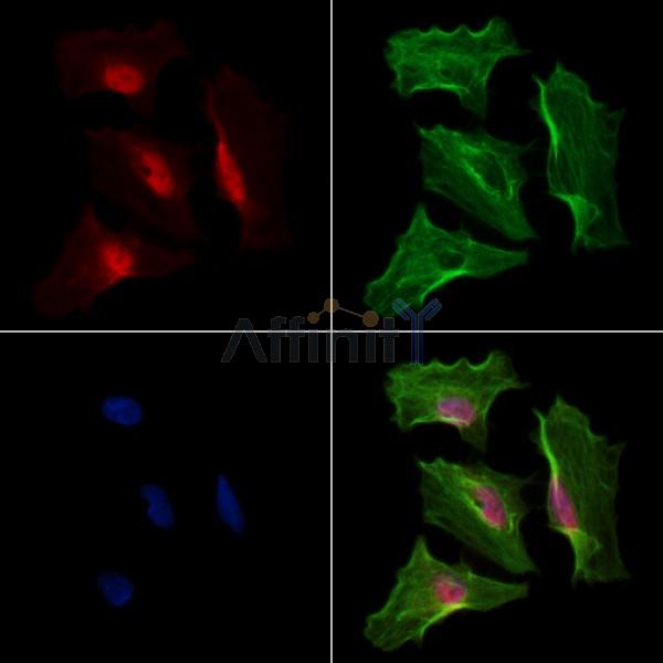 Phospho-Bcl6 (Ser333) Antibody -AF3672