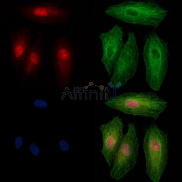 Phospho-PPAR gamma (Ser273) Antibody -AF3675