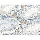 Phospho-VEGFR3 (Tyr1230) Antibody -AF3676