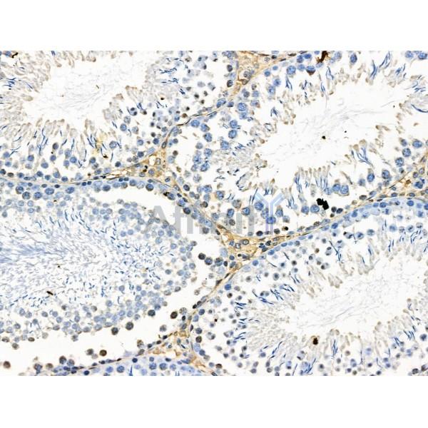 Phospho-VEGFR3 (Tyr1230) Antibody -AF3676