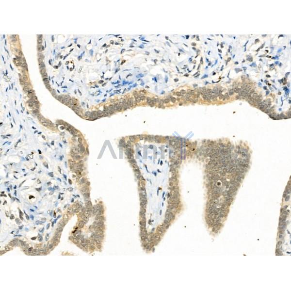 Phospho-YY1 (Ser365) Antibody -AF3694