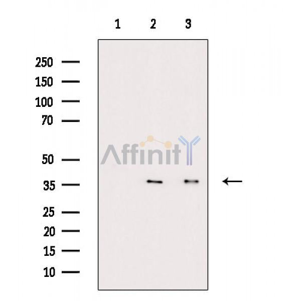 Phospho-FAS (Tyr291) Antibody -AF3695