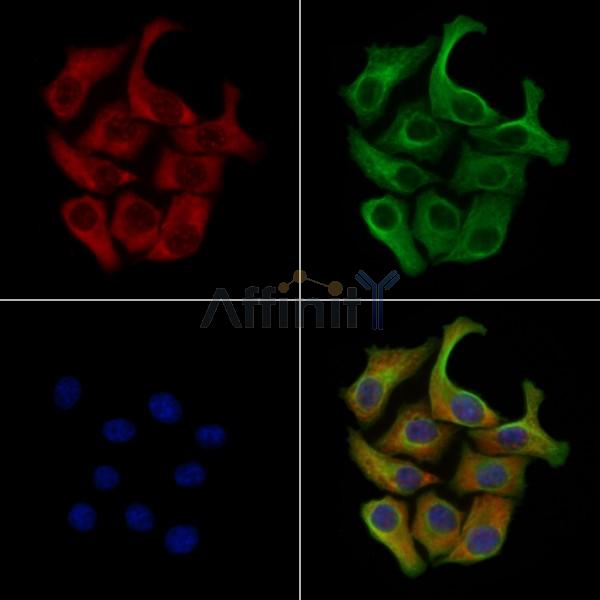 Phospho-GRK2 (Ser670) Antibody -AF3697