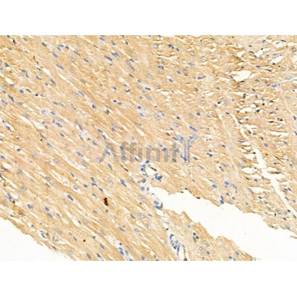 Phospho-IL4R/CD124 (Tyr497) Antibody -AF3699