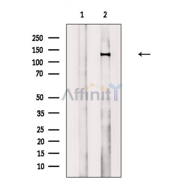 Phospho-JAK1 (Tyr1034/Tyr1035) Antibody -AF3701