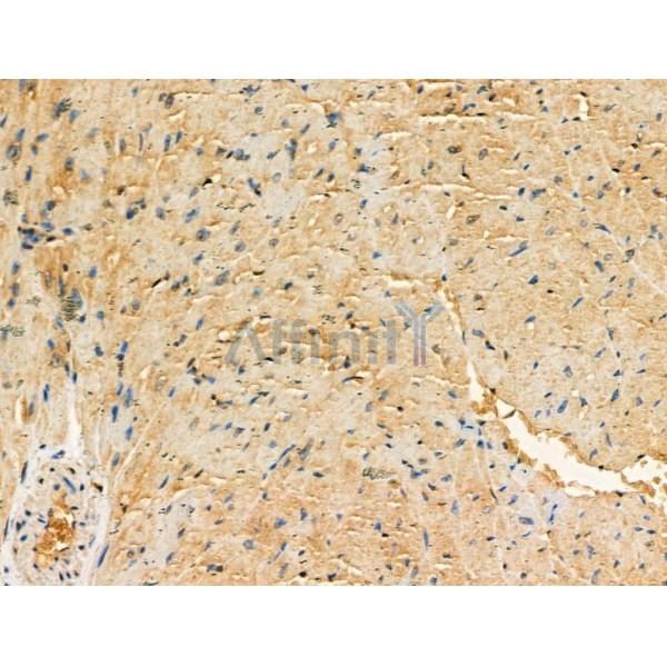 Phospho-RYR1 (Ser2843) Antibody -AF3703