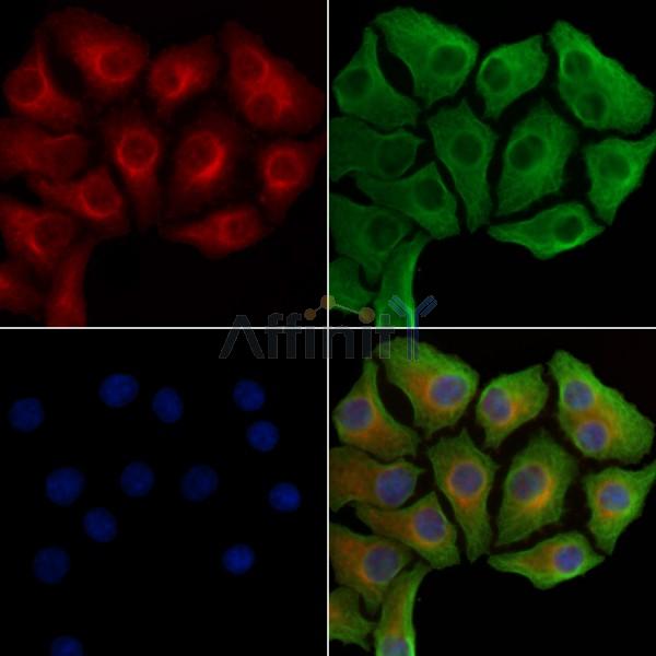 Phospho-Hexokinase 1 (Tyr732) Antibody -AF3709
