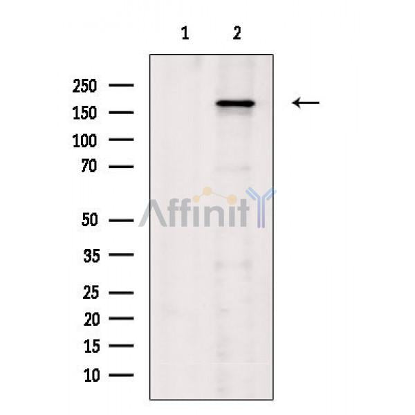 Phospho-VEGFR1 (Tyr1333) Antibody -AF3711