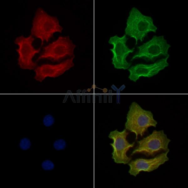 Phospho-Tryptophan Hydroxylase (Ser260) Antibody -AF3713