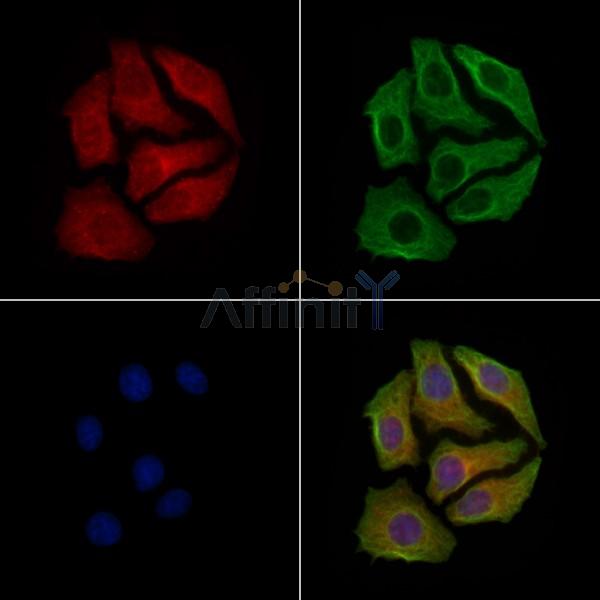 Phospho-GAP43 (Ser41) Antibody -AF3715
