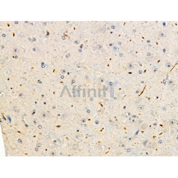 Phospho-Synapsin I (Ser62/Ser67) Antibody -AF3716