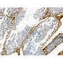 Phospho-IFNAR1 (Tyr466) Antibody -AF3717