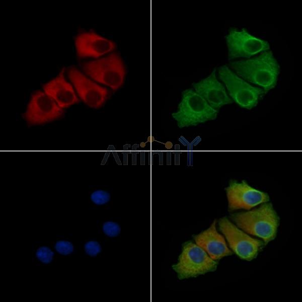 Phospho-Stathmin 1 (Ser63) Antibody -AF3718