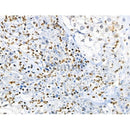 Phospho-RPA32/RPA2 (Ser4/Ser8) Antibody -AF3721