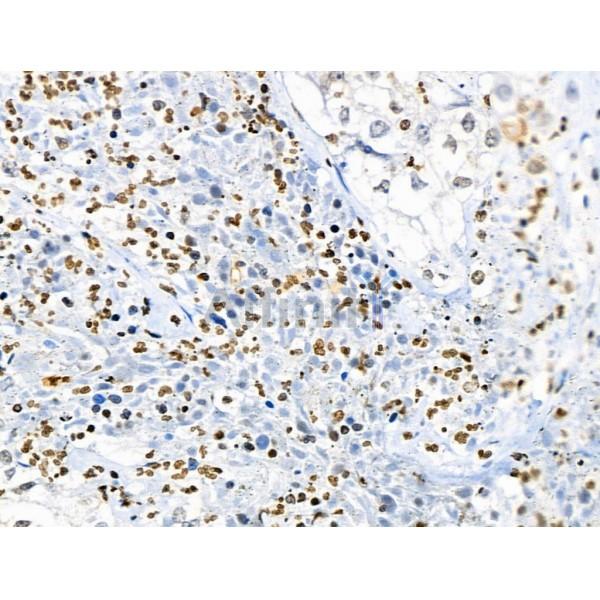 Phospho-RPA32/RPA2 (Ser4/Ser8) Antibody -AF3721
