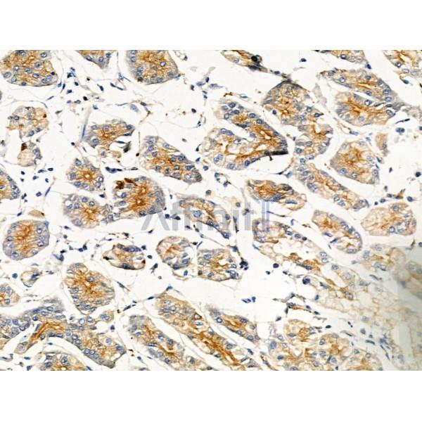 Phospho-Moesin/Ezrin/Radixin (Thr558) Antibody -AF3722