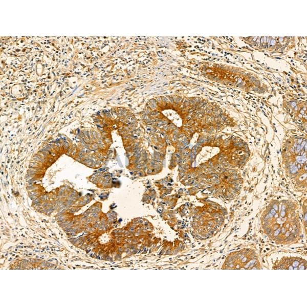 Phospho-PKA R2 (Ser99) Antibody -AF3724