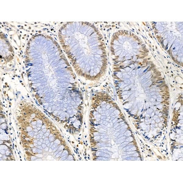 Phospho-TOP2A (Thr1343) Antibody -AF3728