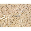 Phospho-TOP2A (Ser1106) Antibody -AF3729