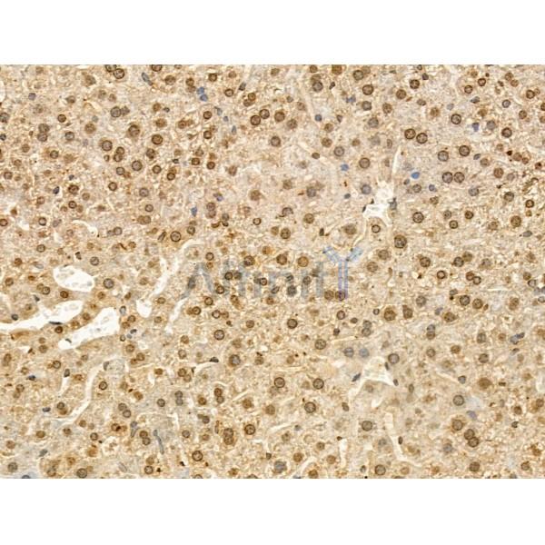 Phospho-TOP2A (Ser1106) Antibody -AF3729