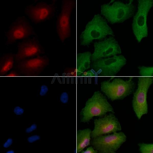 Phospho-FGFR1/2 (Tyr463/Tyr466) Antibody -AF3730
