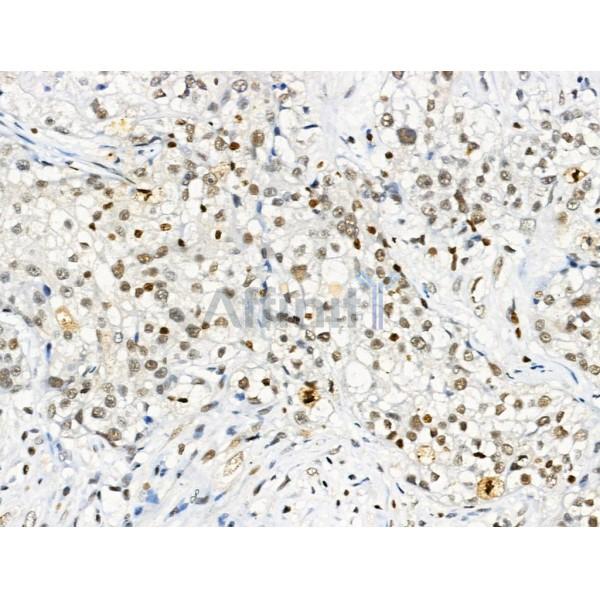 Phospho-Gli2 (Ser149) Antibody -AF3733