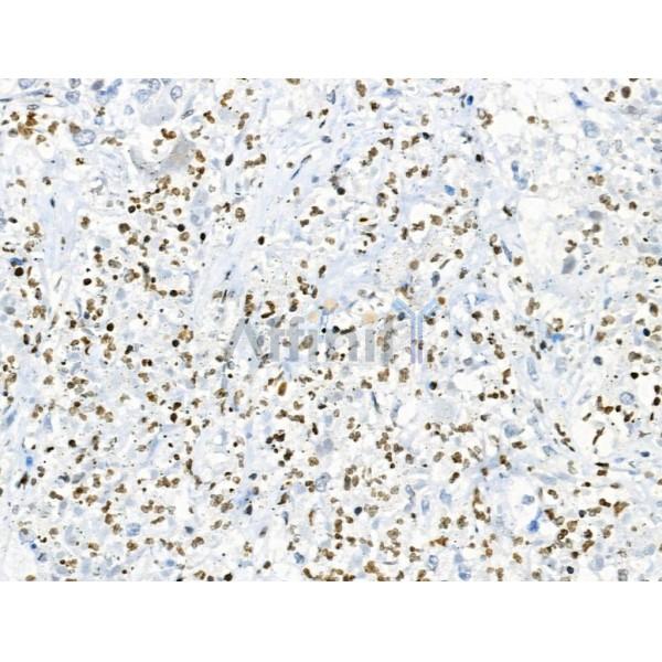 Phospho-HSP70 (Ser153) Antibody -AF3734