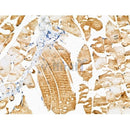 Phospho-Hck/Lyn (Tyr410/Tyr397) Antibody -AF3735