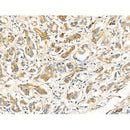 Phospho-EPRS (Ser886) Antibody -AF3737