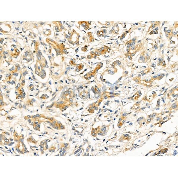 Phospho-EPRS (Ser886) Antibody -AF3737