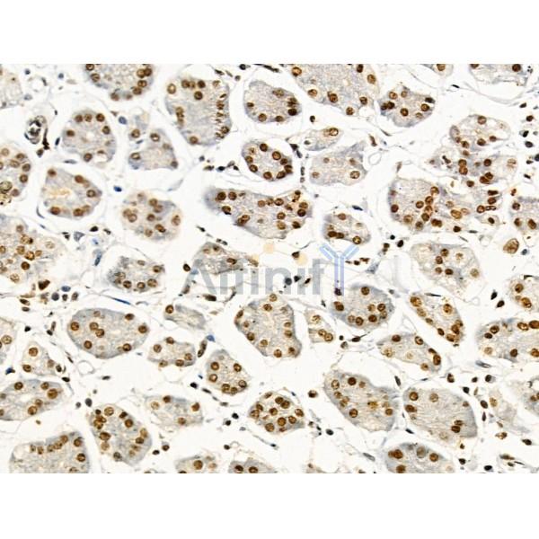 Phospho-Nucleophosmin (Ser125) Antibody -AF3740