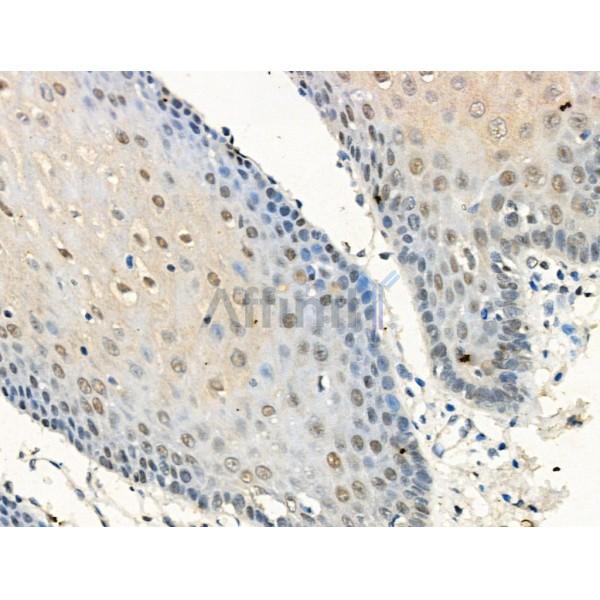 Phospho-Progesterone Receptor (Ser190) Antibody -AF3742