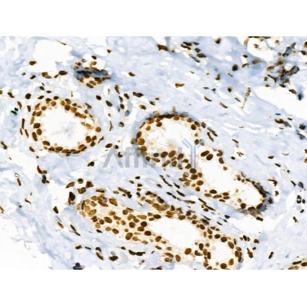 Acetyl-P53 (Lys386) Antibody -AF3746