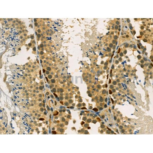 Acetyl-P53 (Lys319) Antibody -AF3747