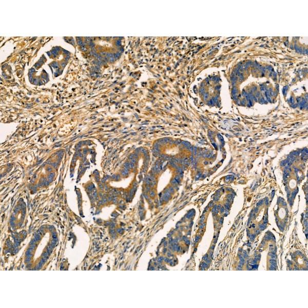 Acetyl-SOD2/MnSOD (Lys68) Antibody -AF3751