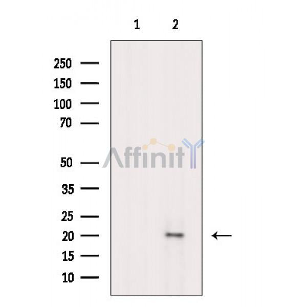 Phospho-CRYAB (Ser59) Antibody -AF3754