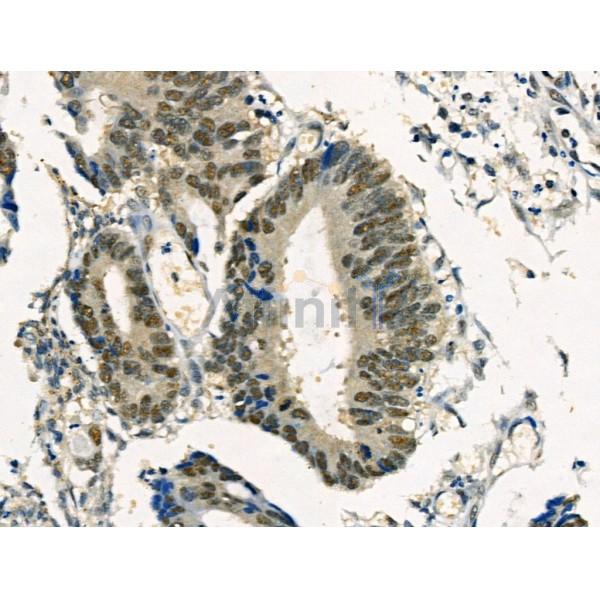 Phospho-SNAIL (Ser11) Antibody -AF3756