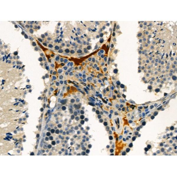 Phospho-ABCA1 (Ser2054) Antibody -AF3758