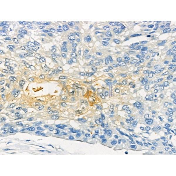 Phospho-XIRP1 (Ser295) Antibody -AF3762