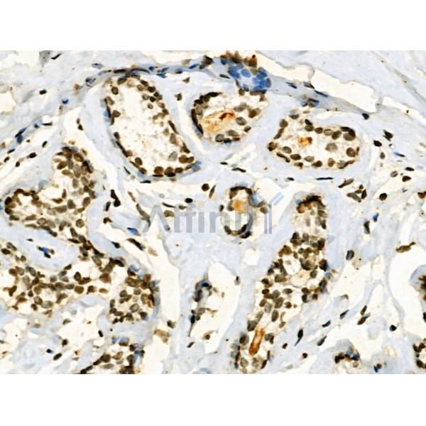 Phospho-Jak2 (Tyr1008) Antibody -AF3763