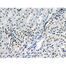 Phospho-JAK2 (Tyr1007/Tyr1008) Antibody -AF3764