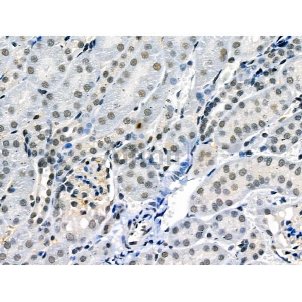 Phospho-JAK2 (Tyr1007/Tyr1008) Antibody -AF3764