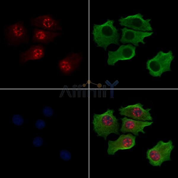 Phospho-Bub1 (Thr461) Antibody -AF3768