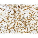 Acetyl-FOXO3A (Lys271) Antibody -AF3771