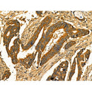 Phospho-RAB7L1 (Thr71) Antibody -AF3777