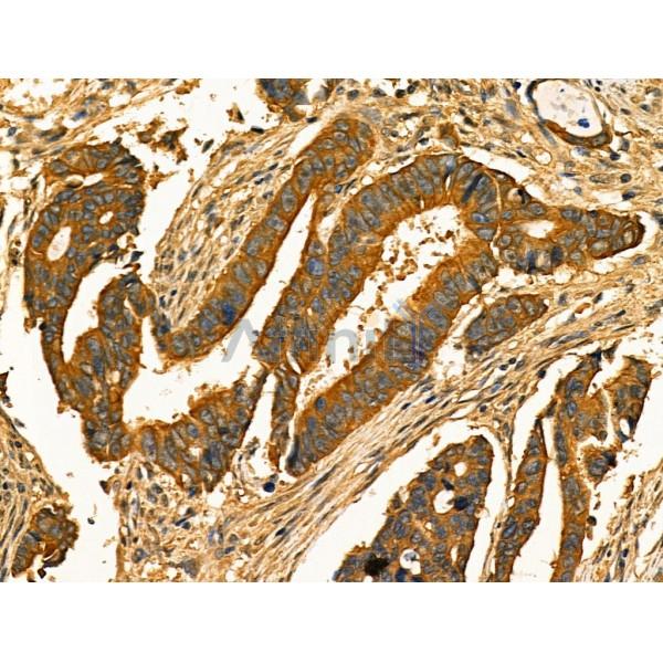 Phospho-RAB7L1 (Thr71) Antibody -AF3777