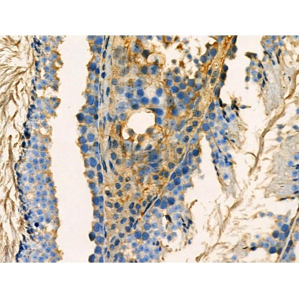 Phospho-RAB7L1 (Ser72) Antibody -AF3778