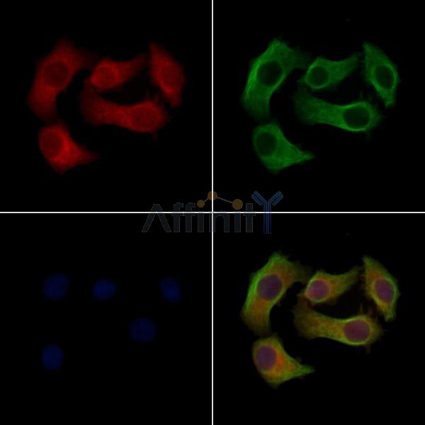 Phospho-SCD1 (Tyr55) Antibody -AF3781