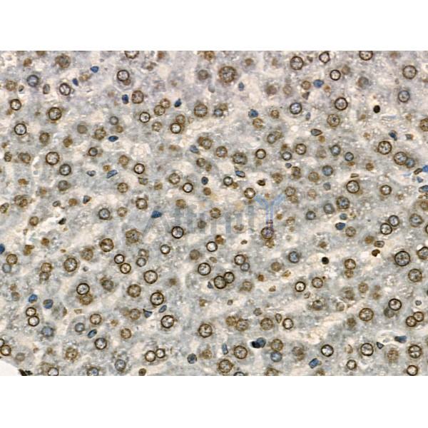 Phospho-eEF2K (Ser491/Ser492) Antibody -AF3785