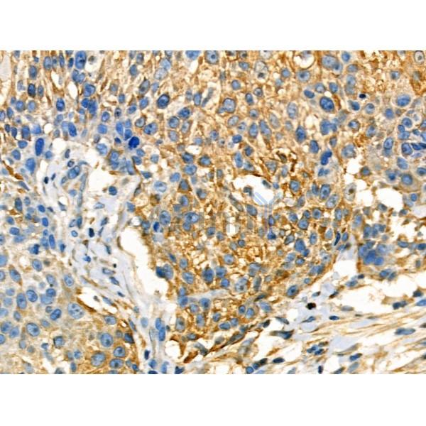 Phospho-FXYD1/PLM (Ser88/Ser89) Antibody -AF3787